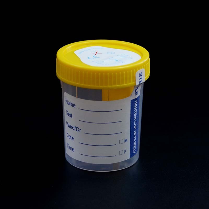 High Quality 100ml Disposable Vacuum Urine Container with Temperature Strip
